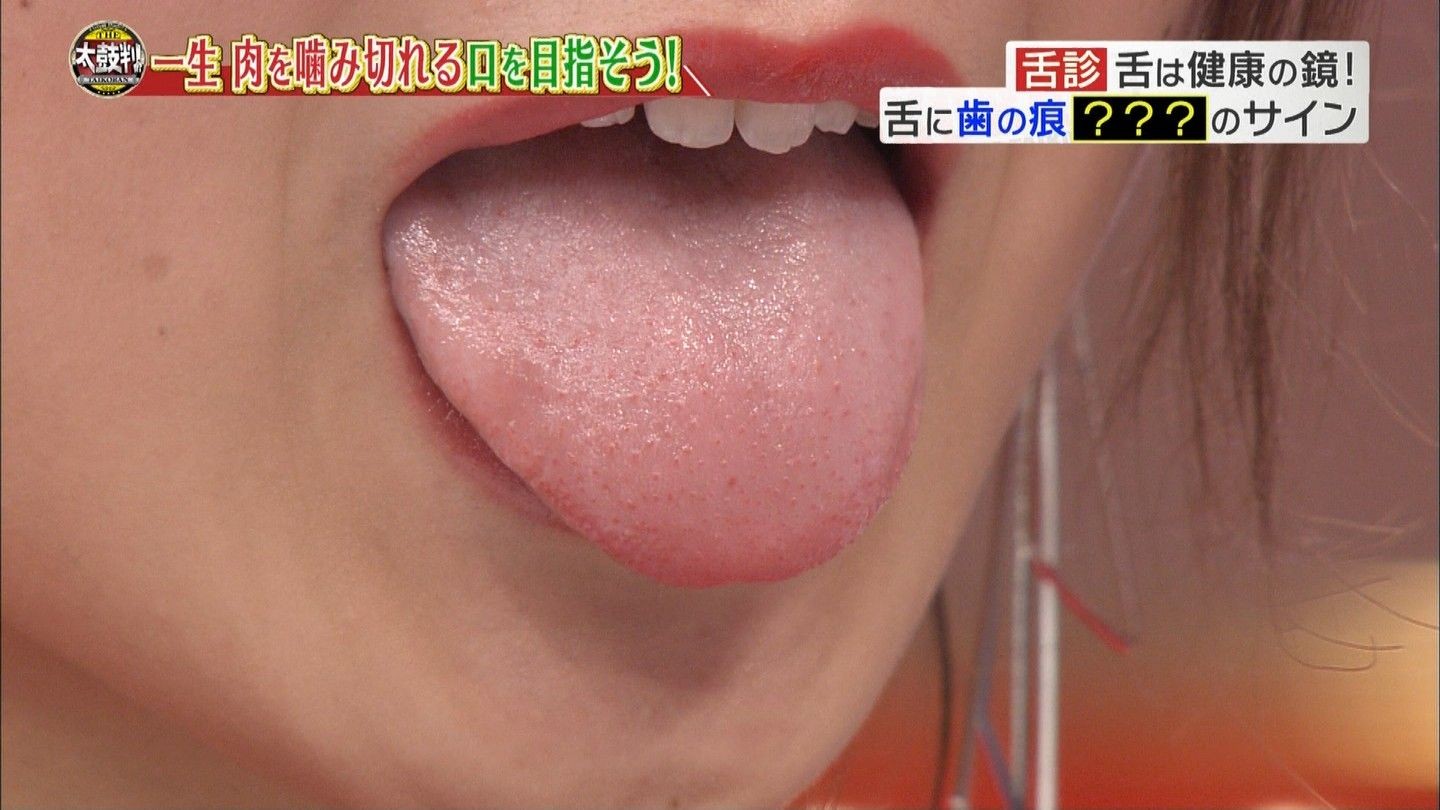 [Image is] Michopa's tongue wwwwwwwwwww