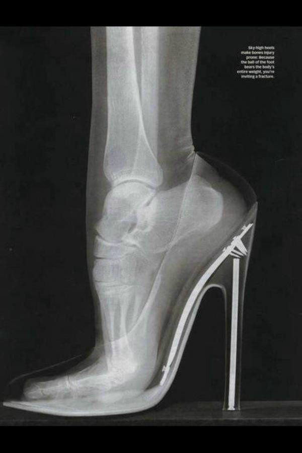 [Reading notice] Women who wear torture shoes such as high heels